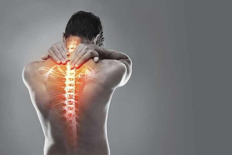 Osteocondrosi della regione di cervice