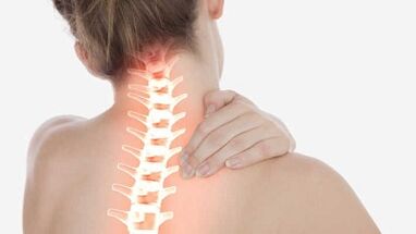 Le principali manifestazioni dell'osteocondosi cervicale