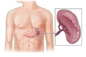 Patologia della milza come causa di dolore sotto la scapola sinistra