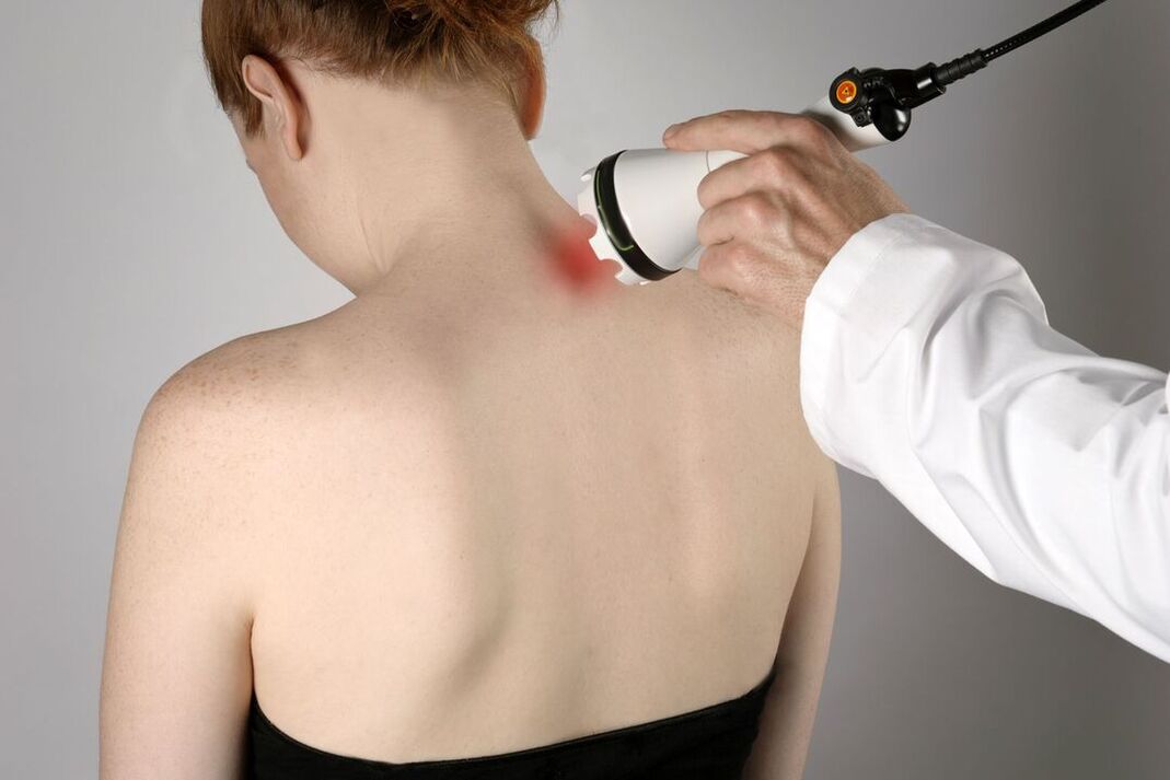 Trattamento fisioterapico dell'osteocondrosi cervicale